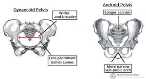 Contracted Pelvis - Physiopedia