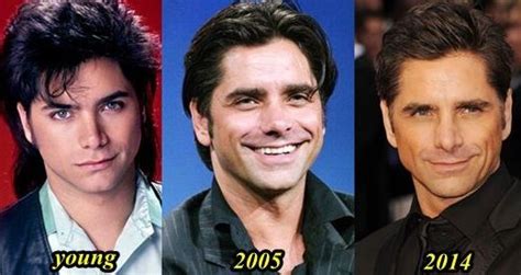 John Stamos before and after plastic surgery 09 – Celebrity plastic ...