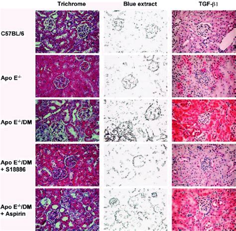 S18886 Reduces Renal Cortex Extracellular Matrix Deposition And Tgf 1