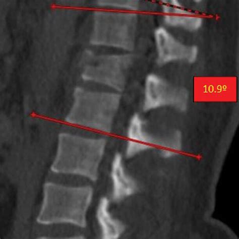 Sagittal Computed Tomography Download Scientific Diagram