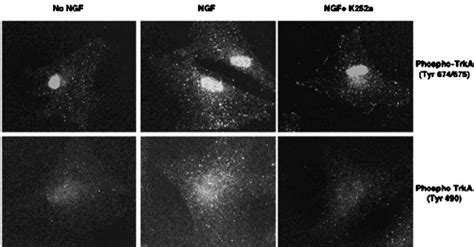 Inhibition Of Nerve Growth Factor Ngf Dependent Activation Of Trka By