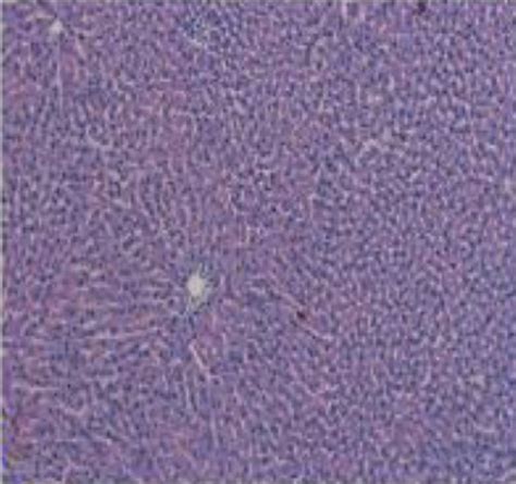 Histopathological Analysis Liver Tissues Showing A The Normal Download Scientific Diagram