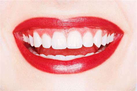 The 13 Best Teeth-Whitening Products Out There | Who What Wear