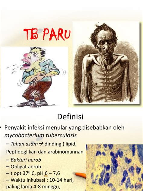 Pdf Tb Paru Fix Ppt Dokumen Tips