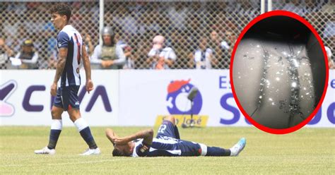 Alianza Lima Tito Ordóñez Denuncia Que Bus De Alianza Lima Fue Apedreado Y Un Futbolista