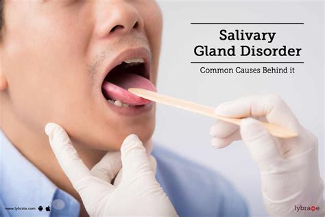 Salivary Gland Disorder Common Causes Behind It By Dr Jagdish