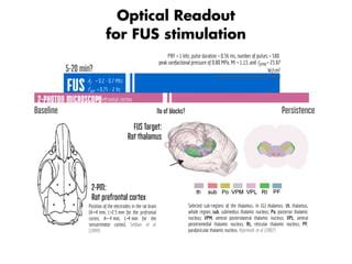 Focused Ultrasound Neuromodulation PPT