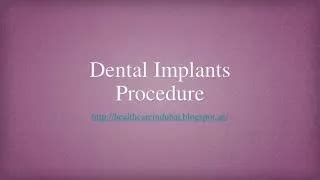 Ppt Understanding Dental Implants Procedure Benefits And