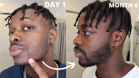 My Minoxidil Beard 6 Month Transformation Week 29 Update Youtube