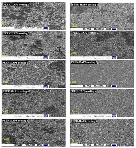 Nanomaterials Free Full Text Drug Releasing Antibacterial Coating