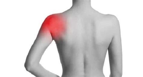 These Home Remedies Will Help You Shrug Off Shoulder Pain