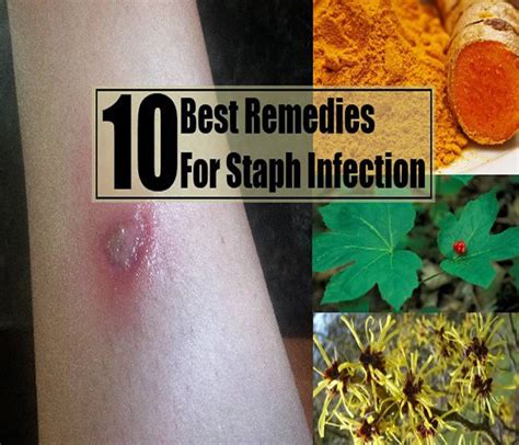 Staphylococcuss Causes Symptoms Treatment Diagnosis And Prevention