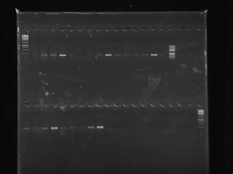 Primer Dimer In Gel Electrophoresis