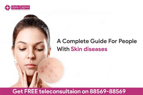 A Complete Guide For People With Skin Diseases Ujala Cygnus