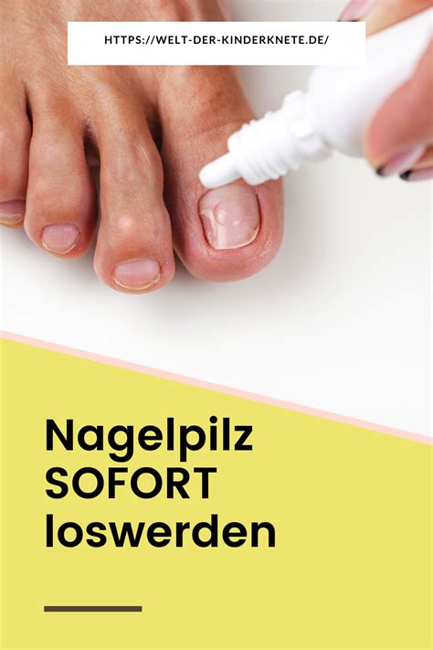 Erwiesen So Kannst Du Nagelpilz Wirklich Loswerden Nagelpilz