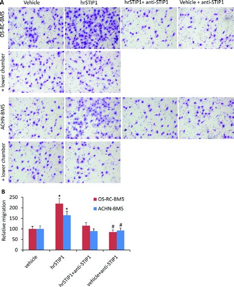 Stip1 Promotes Tumor Cell Migration Invasion A Representative Images