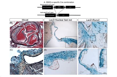 Lineage Tracing Of Runt Related Transcription Factor 2 Runx2