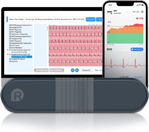 Wireless Ecg Acquiring System At Stanley Anderson Blog