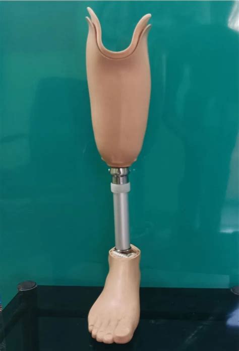 Carbon Fiber Leg Beige Modular Below Knee Prosthesis At Rs In Patna