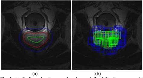 Figure From Prostate Segmentation In Mr Images Using Ensemble Deep