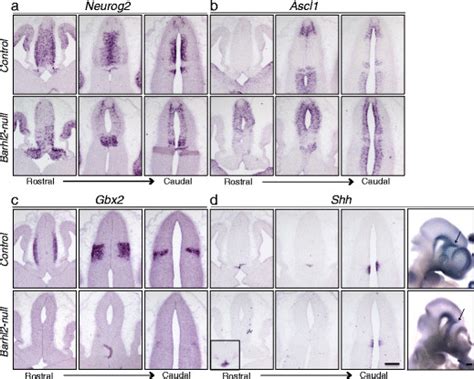 Barhl Acts Upstream Of Shh And Regulates Pro Neural Gene Expression