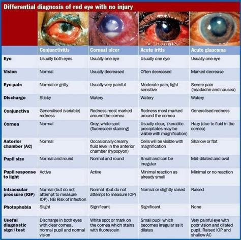 102 best images about eyes on Pinterest | Eye close up, Scanning electron micrograph and Eyelashes