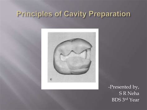 Principles Of Cavity Preparation Ppt