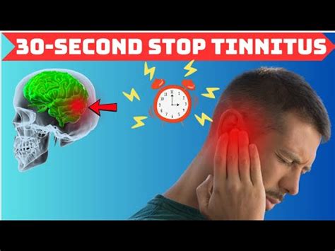 The FASTEST Way To STOP TINNITUS 30 SECOND Technique To SILENCE