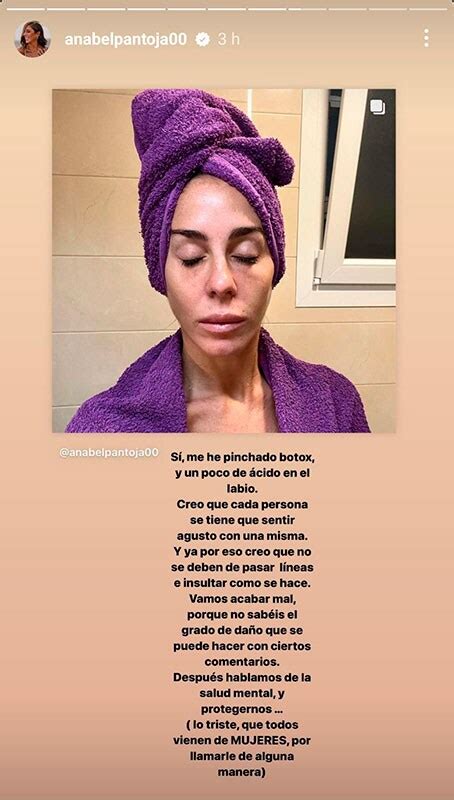 Anabel Pantoja estalla por las críticas a sus retoques estéticos Foto 3