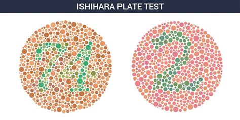 Colour Blindness Causes Symptoms Diagnosis With The Treatment