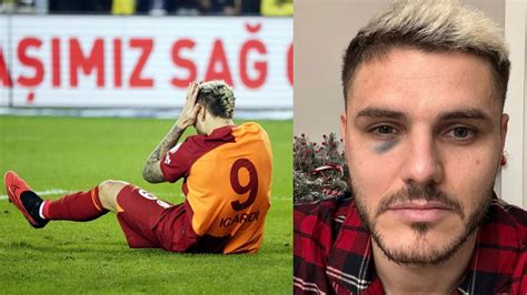 Son Dakika Mauro Icardi Nin Trabzonspor Ma Ak Beti Belli Oldu