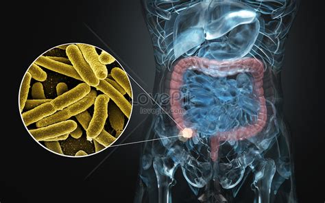 Human intestinal diseases creative image_picture free download ...