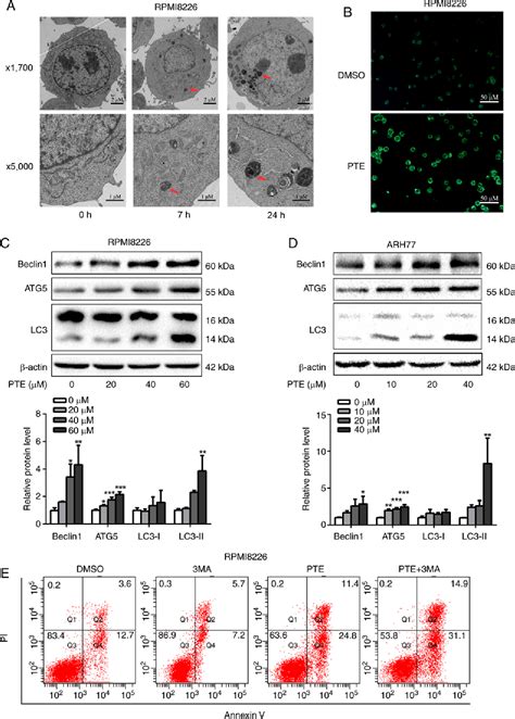 Figure 1 From Pterostilbene Inhibits Nutrient Metabolism And Induces