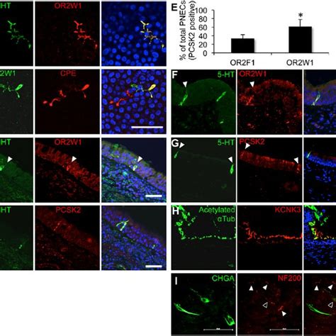 A 5 HT Receptor HTR Gene Expression By Microarray Analysis Of