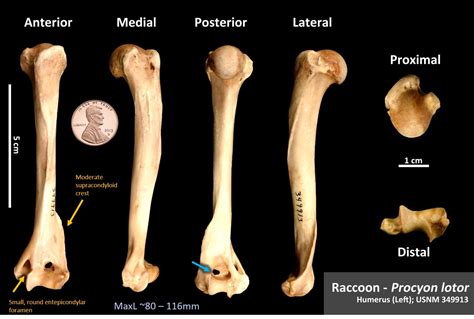 Bones Osteoid Bone Identification