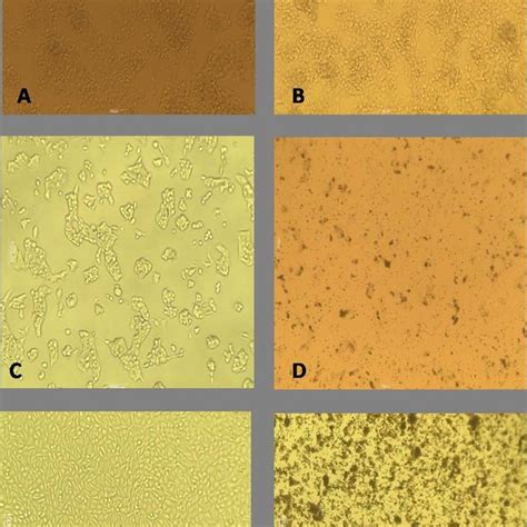 A-F. Shows the cytotoxic inhibitory effect on cell viability by the ...