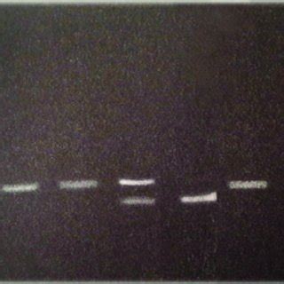 Genotyping results of TNF-α gene polymorphism-308 G | Download ...