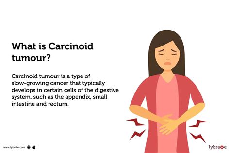 Carcinoid Tumour Causes Symptoms Treatment And Cost