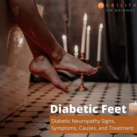 Diabetic Feet Signs Symptoms Causes And Treatment Mobility On Mainway