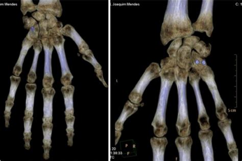 3d Ct Scan Reconstruction Download Scientific Diagram