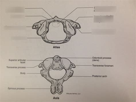 Pivot Joint, Atlas (Lab 5) Diagram | Quizlet