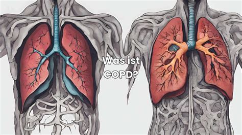 Ist COPD heilbar Erfahre alles über mögliche Behandlungen