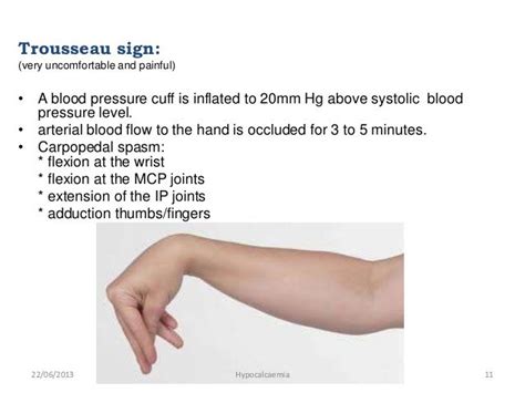 Hypocalcaemia Trousseau S Sign Medical Knowledge Medical School Essentials Nursing Mnemonics