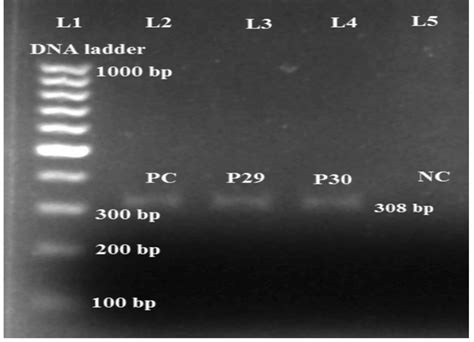 PCR Amplification Of Mcr 1 Gene In MDR P Aeruginosa Isolates