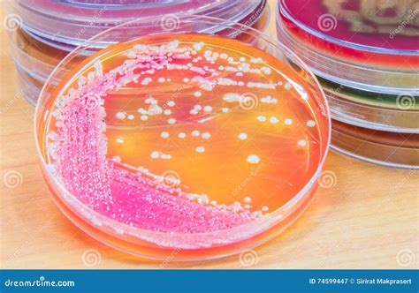 Bacterial Culture Growth On Agar Plate Stock Image Image Of Growth