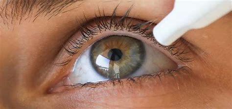 Contact Lens Rules People With Dry Eyes Should Always