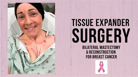 Another Surgery Tissue Expanders Breast Cancer Reconstruction Invasive Ductal Carcinoma