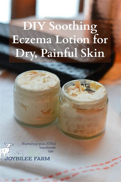 DIY Eczema Cream - Joybilee® Farm | DIY | Herbs | Gardening