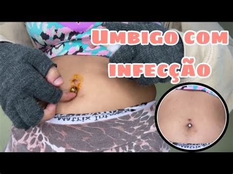 Como limpar umbigo infecção em casa Umbigo piercing YouTube