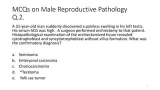 MCQs in male reproductive pathology ss1 | PPT